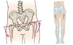 حرکات اصلاحی چرخش لگن راهکار علمی برای بهبود تعادل بدن و کاهش درد