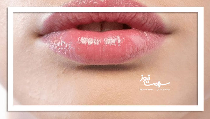 چرا لب‌ها نازک می‌شوند؟
