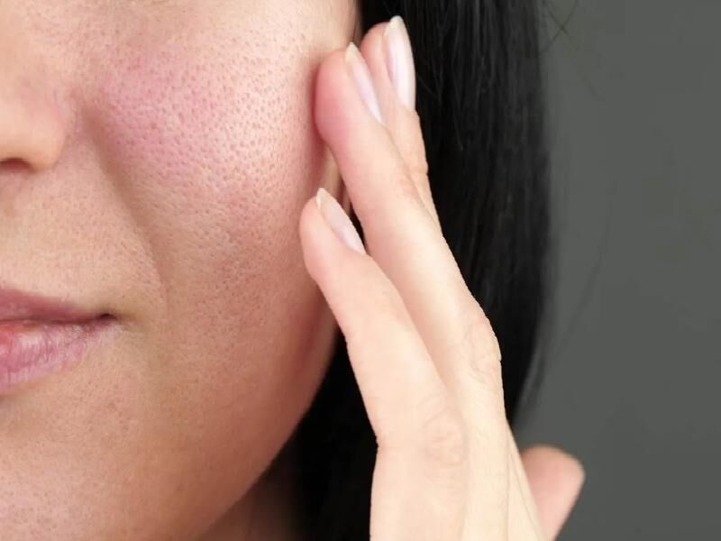 اشتباهات رایج در انتخاب کرم برای منافذ باز پوست