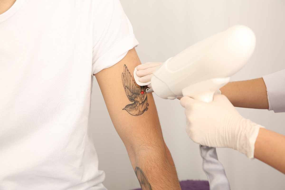 آیا پاک کردن تاتو درد دارد؟ میزان درد و نکات تسکین آن