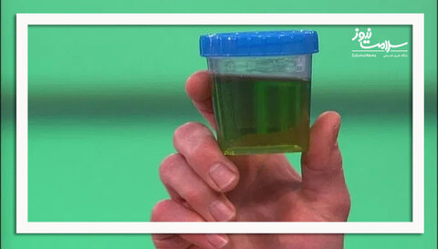 چرا ادرارم سبز رنگ شده است؟