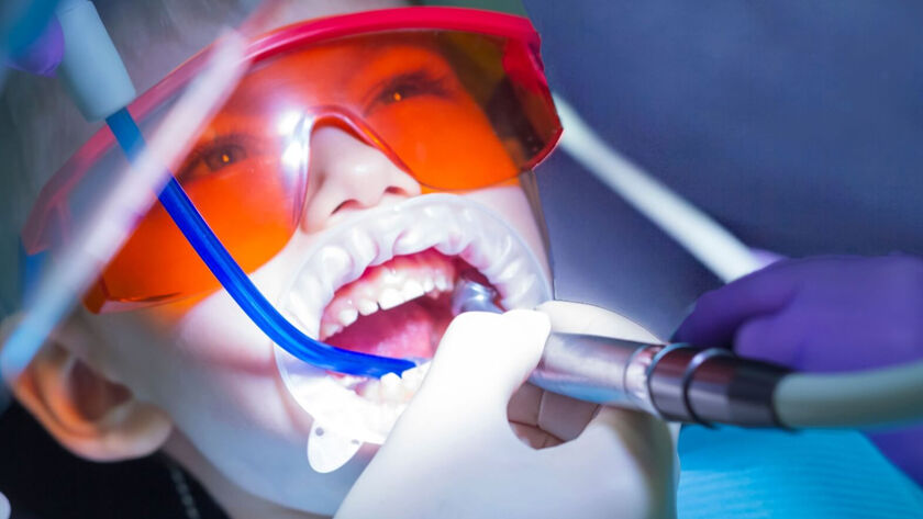 دندانپزشکی با لیزر بدون درد چیست؟ تجربه درمان بدون ترس در دندانپزشکی مدرن