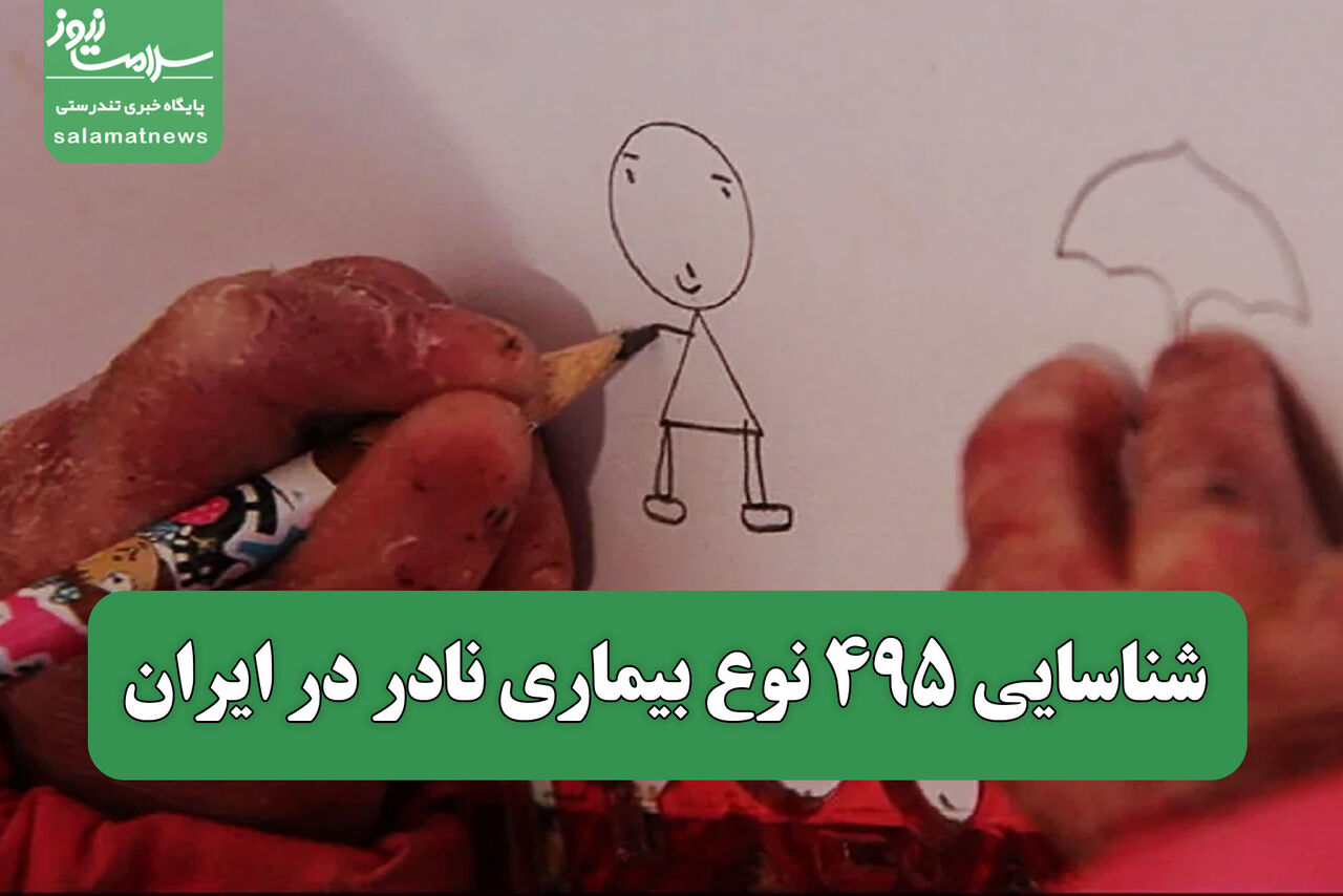 شناسایی ۴۹۵ نوع بیماری نادر در ایران