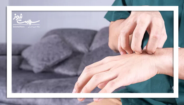 علتهای راش روی مچ دست و روشهای درمان آن علتهای راش روی مچ دست و روشهای درمان آن