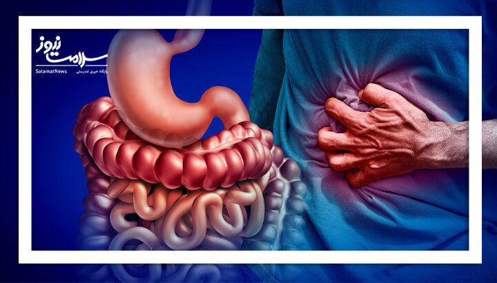 بیماری‌های التهابی روده (IBD) بعد از جراحی دوباره برمی‌گردند؟
