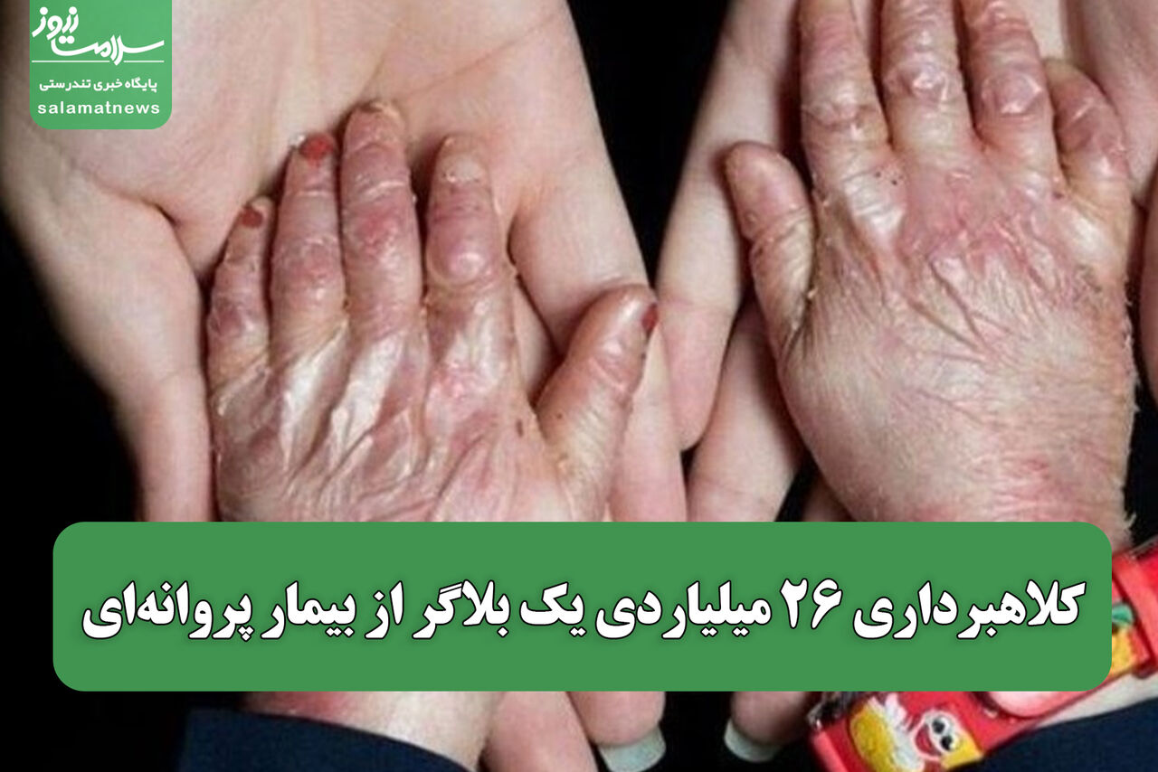 کلاهبرداری ۲۶ میلیاردی یک بلاگر از بیمار پروانه‌ای