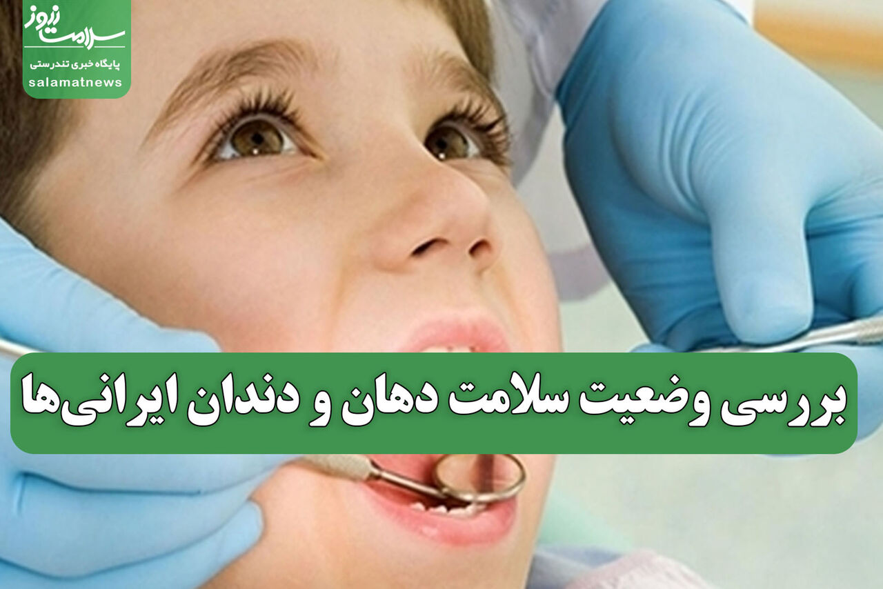 بررسی وضعیت سلامت دهان و دندان ایرانی‌ها