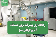 راه‌اندازی پیشرفته‌ترین دستگاه آنژیوگرافی مغز