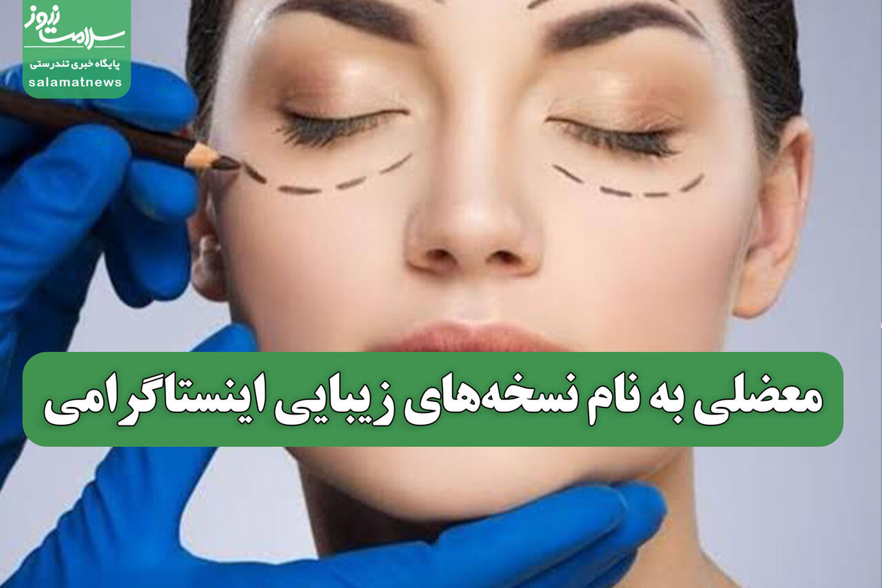 معضلی به نام نسخههای زیبایی اینستاگرامی معضلی به نام نسخههای زیبایی اینستاگرامی
