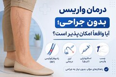درمان واریس بدون جراحی؛ آیا واقعاً امکان‌ پذیر است؟
