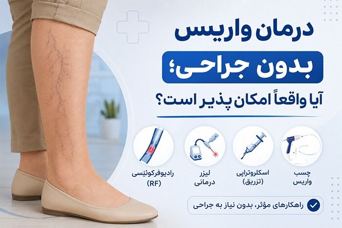 آیا درمان واریس بدون جراحی ممکن است؟