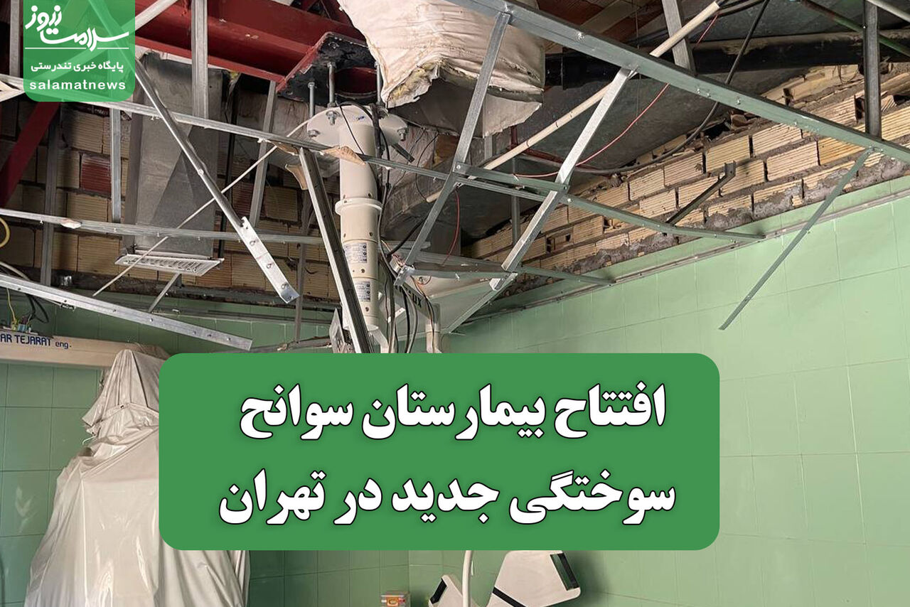 افتتاح بیمارستان سوانح سوختگی جدید در تهران