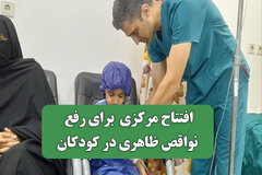 افتتاح مرکزی برای رفع نواقص ظاهری در کودکان