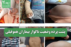 پشت پرده وضعیت ناگوار بیماران هموفیلی