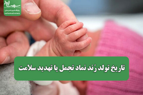 تاریخ‌ تولد رُند نماد تجمل یا تهدید سلامت