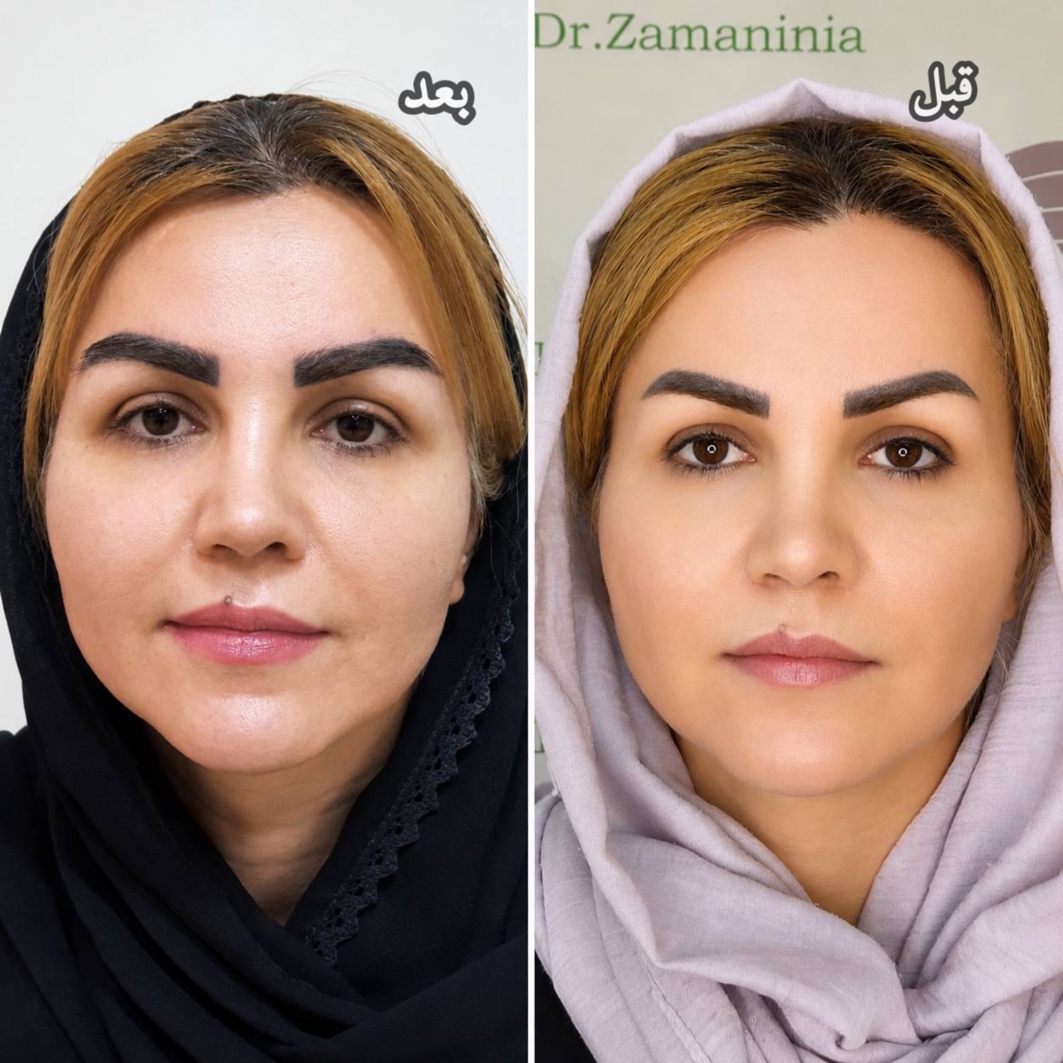 اگر از چین و چروک خسته شده اید، این راه حل را از دست ندهید