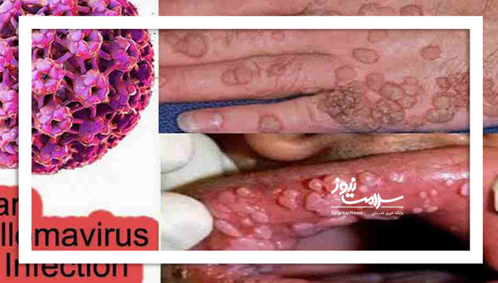 پیشروی بیصدای یک ویروس پیشروی بیصدای یک ویروس