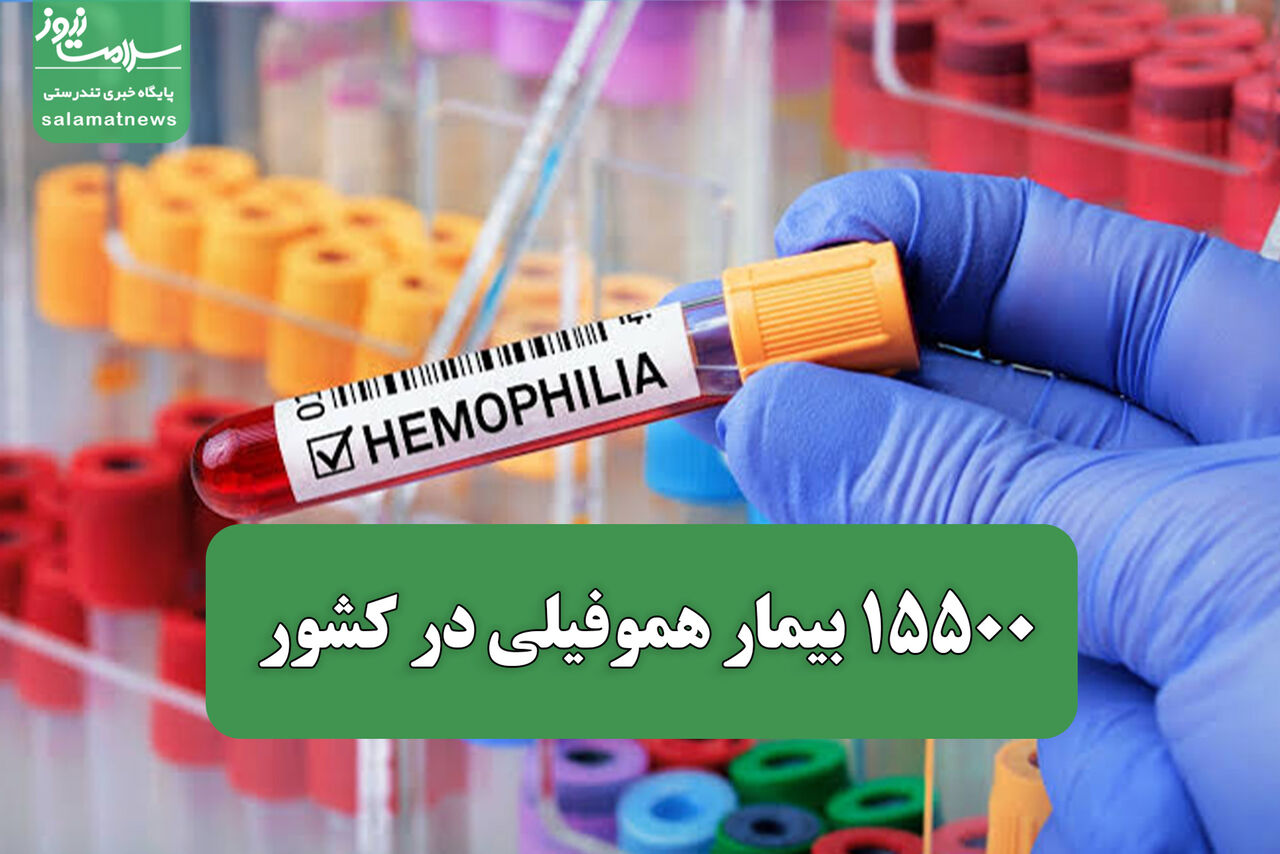 ۱۵۵۰۰ بیمار هموفیلی در کشور / ازدواج‌ فامیلی و سابقه خانوادگی از علل خطر ابتلا