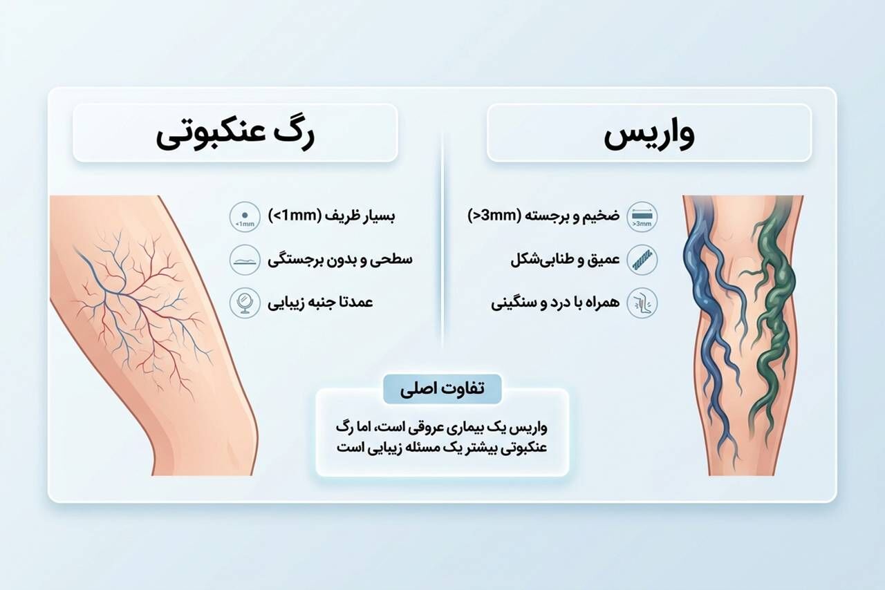تفاوت تلانژکتازی و واریس چیست؟ راهنمای ساده برای تشخیص