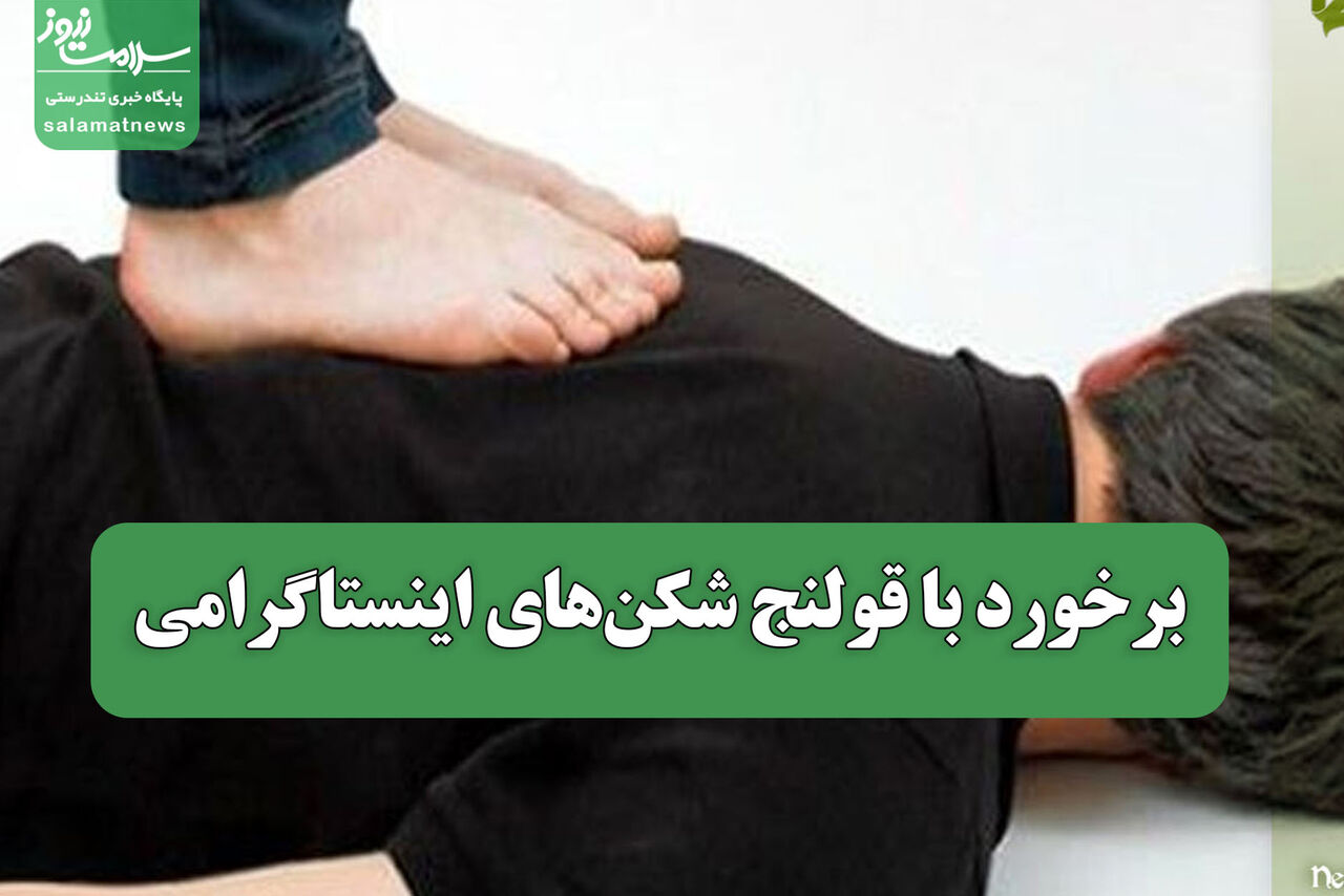 برخورد با قولنج شکن‌های اینستاگرامی