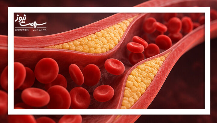 برای کاهش LDL چه بخوریم؟/ اندازه غذا مهم‌تر است یا نوع آن؟