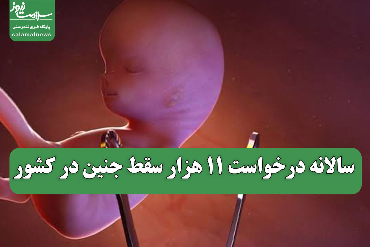 سالانه درخواست 11 هزار سقط جنین در کشور 