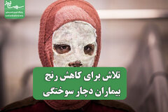 تلاش برای کاهش رنج بیماران دچار سوختگی