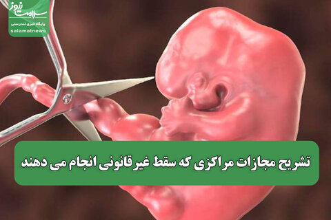 تشریح مجازات مراکزی که سقط غیرقانونی انجام می دهند