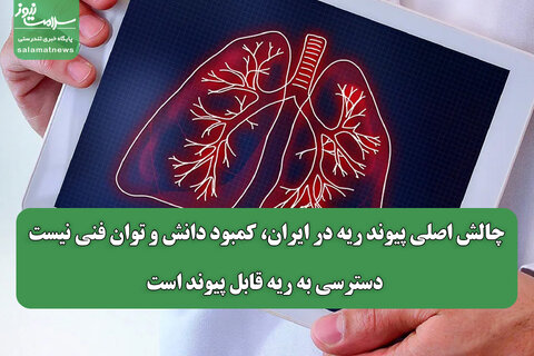 چالش اصلی پیوند ریه در ایران، کمبود دانش و توان فنی نیست؛  دسترسی به ریه قابل پیوند است