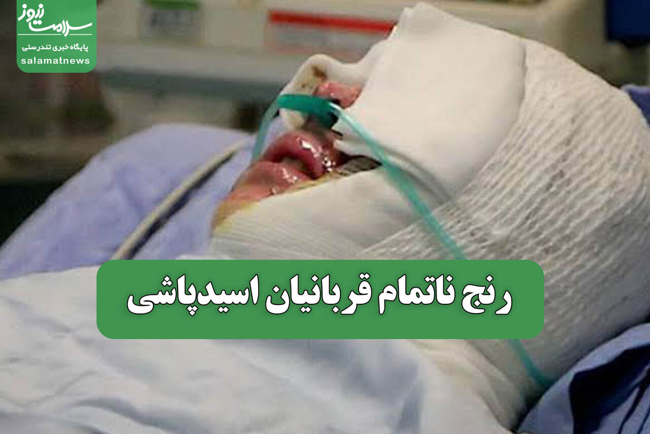 رنج ناتمام قربانیان اسیدپاشی