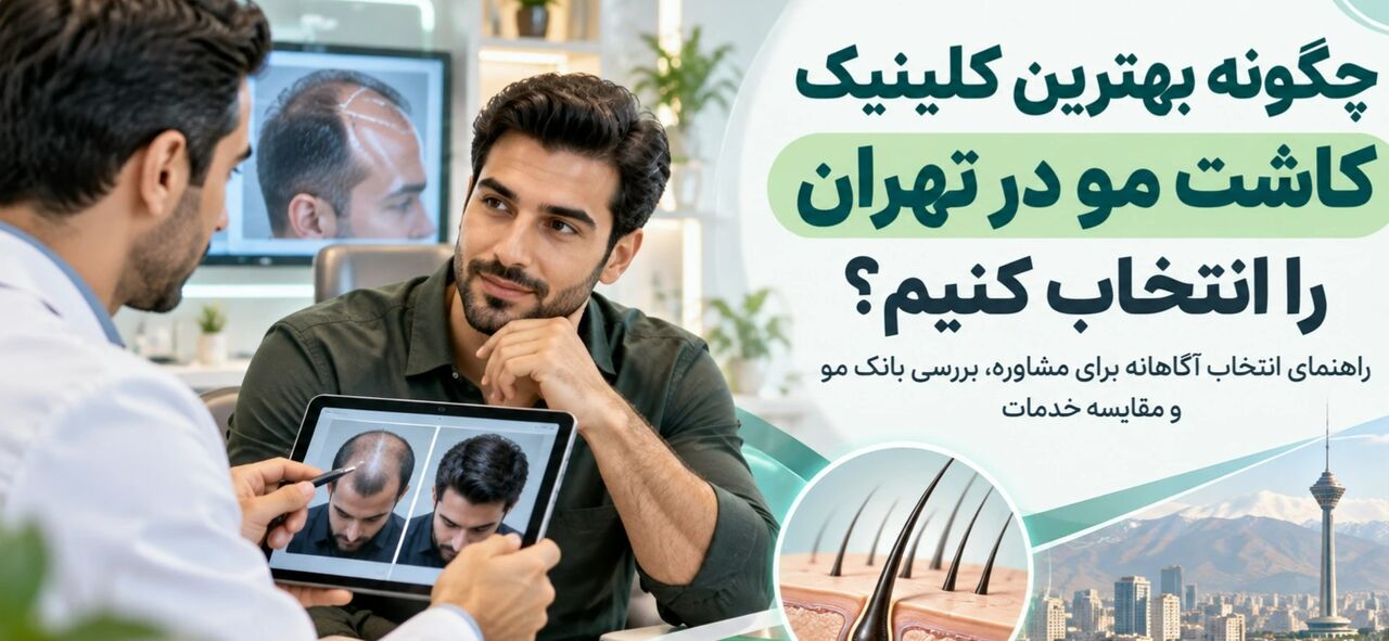 چگونه بهترین کلینیک کاشت مو در تهران را انتخاب کنیم؟