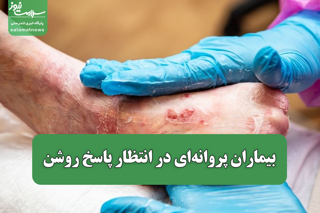 بیماران پروانه‌ای در انتظار پاسخ روشن