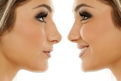 چگونه جراح بینی را انتخاب کنیم؟ 7 معیار مهم قبل از رینوپلاستی