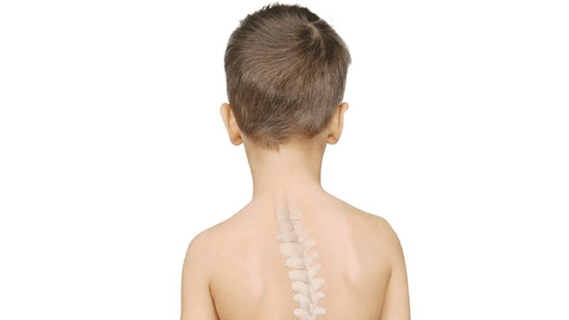 هشدار جراح ستون فقرات درباره علائم خطرناک در کودکان