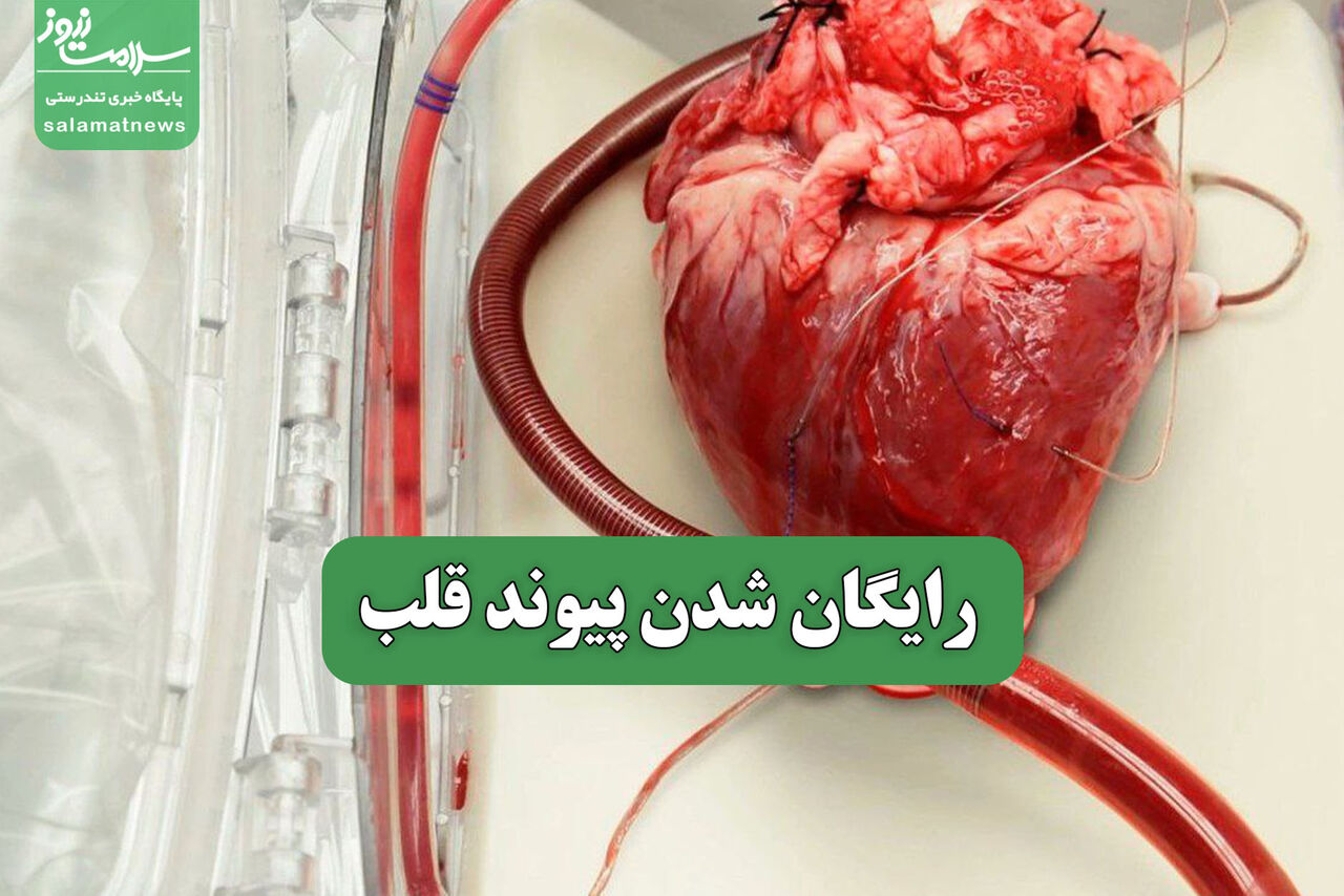 رایگان شدن پیوند قلب 