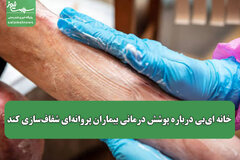 خانه ای‌بی درباره پوشش درمانی بیماران پروانه‌ای شفاف‌سازی کند