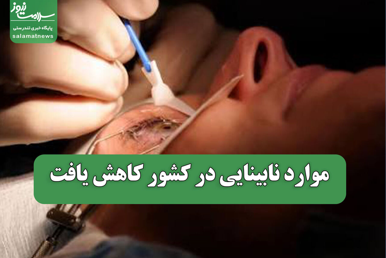 موارد نابینایی در کشور کاهش یافت