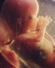 سقط قانونی جنین در كشور، آمار تالاسمی را كاهش داده است