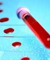پژوهشگران آلمانی ماده ضد ویروس ایدز در خون كشف كردند