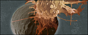 حرکات نرمشی از شکل‌گیری توده‌های سرطان‌زاد در دستگاه گوارش جلوگیری می‌کند