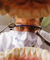 آیا جرمگیری دندان‌ها را خراب می‌كند؟