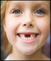 افتادن دندان‌های شیری کودکان قبل از ۶ سالگی طبیعی است