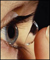 امید تازه برای مبتلایان به اختلالات شدید قرنیه با لنز تماسی جدید
