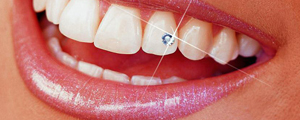 چسباندن نگین دندان در آرایشگاه‌ها موجب آسیب دیدن دندان‌ها می‌شود