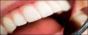 به تعویق افتادن طرح ساماندهی لابراتوارهای دندانسازی از سوی وزارت بهداشت/ خطرآفرینی لابراتوارهای غیرمجاز برای سلامت جامعه