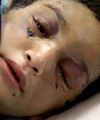 آخرین وضعیت هانیه 8 ساله بعد از شکنجه