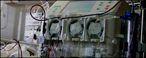 اجرای طرح پلاسما فرز در بیمارستان بزرگ نفت اهواز آغاز شد 