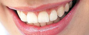 دندان عقل سالم مشکلی برای دندانهای مجاور بوجود نمی آورد
