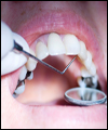خدمات دندانپزشکی همچنان دور از دسترس