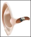 سمعک های بی کیفیت در گوش ناشنوایان